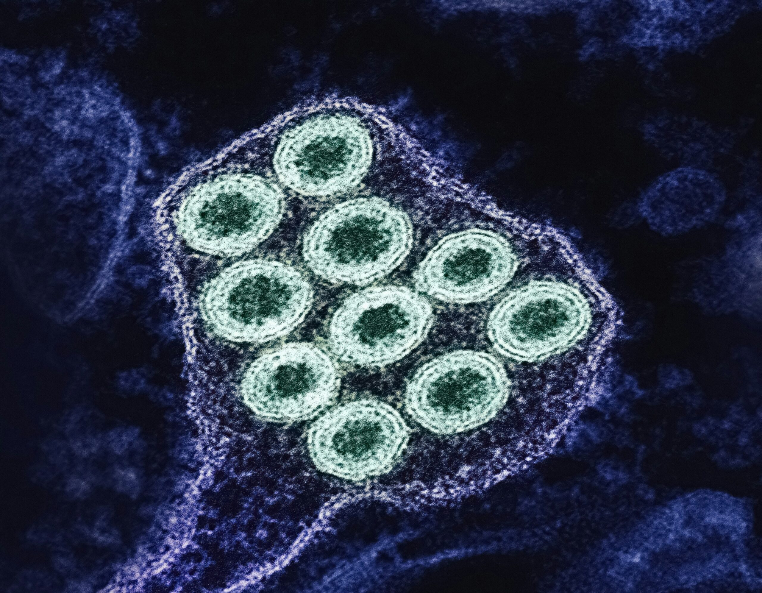 national-institute-of-allergy-and-infectious-diseases-9kqpqAWha64-unsplash